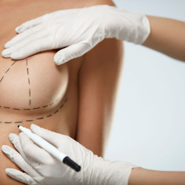 Dra. Ana Karina- plástica em santos-implantes mamários